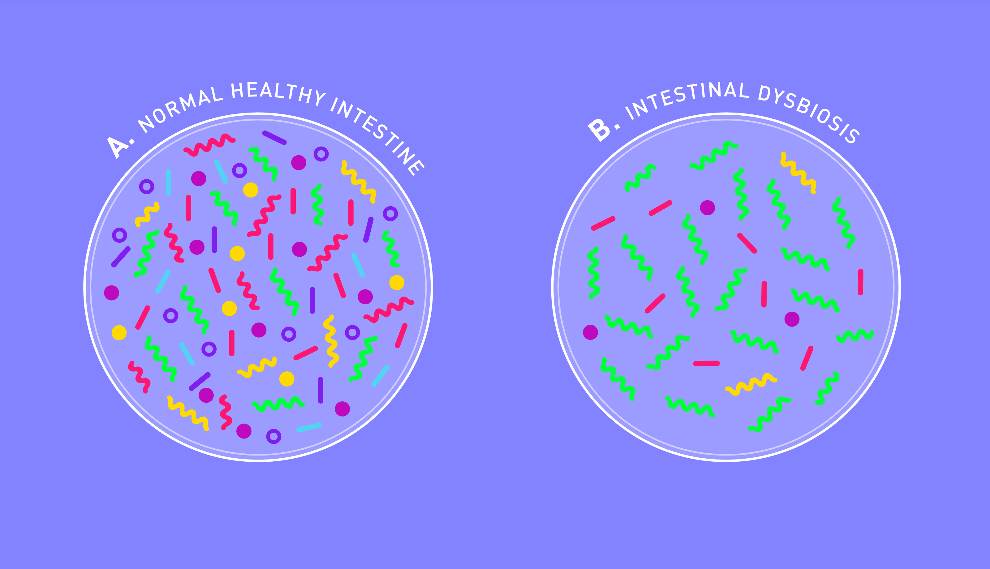 A depleted and unbalanced microbiome plays a role in IBS symptoms