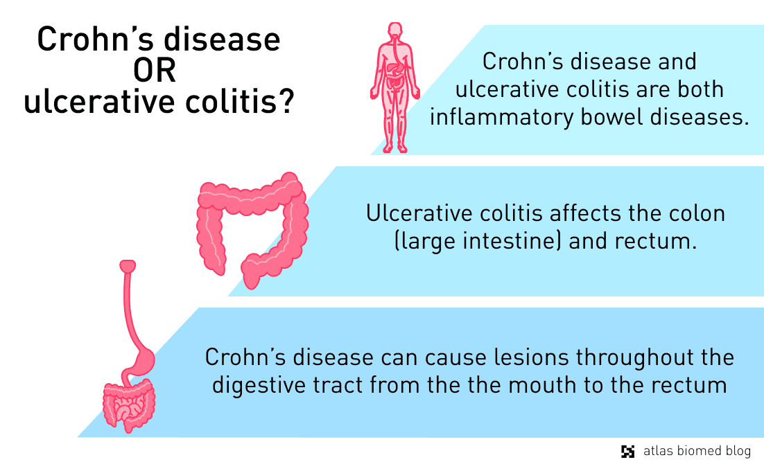 Difference between Crohn's disease and ulcerative colitis by Atlas Biomed.